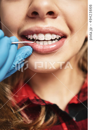 Beauty is power. A smile its sword. Teen at the dental office. Dentist examining girl's teeth in 49423666