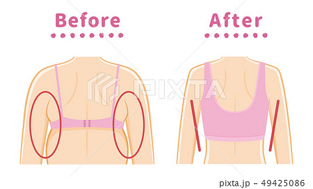 脇のハミ肉　補正下着 49425086
