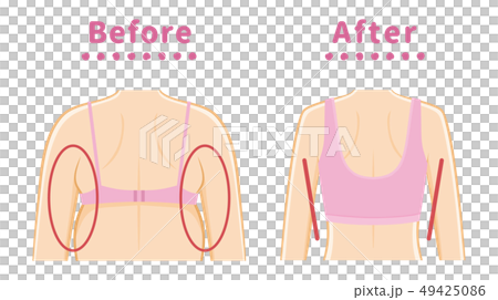 脇のハミ肉 補正下着のイラスト素材