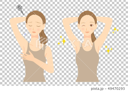 女性　ワキ脱毛　before　after　01 49470293