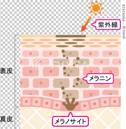 しみ　肌の断面図 49491428