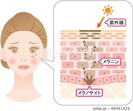 しみの構造 女性の顔と肌の断面図のイラスト素材