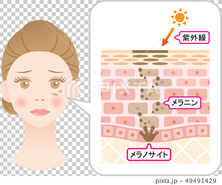 しみの構造 女性の顔と肌の断面図のイラスト素材