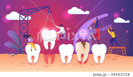 Unhealthy Tooth Removal Process. Tiny People Work Unhealthy Tooth Removal Process. Tiny People Work 49503728