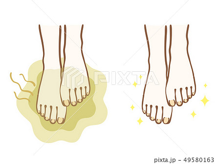 足のニオイ ビフォーアフター 足のニオイ ビフォーアフター 49580163