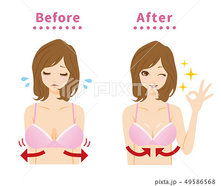 バストの悩み　ビフォーアフター 49586568