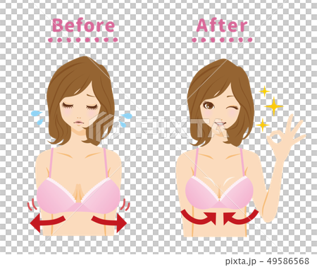 バストの悩み　ビフォーアフター 49586568