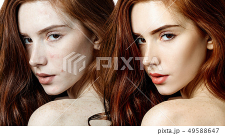 Young woman before and after skin treatment and makeup. Young woman before and after skin treatment and makeup. 49588647