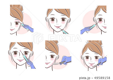 Cosmetic Surgery Conceptのイラスト素材