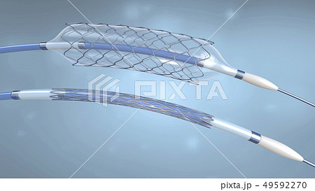 Stent and catheter,implant into blood vesssel 49592270