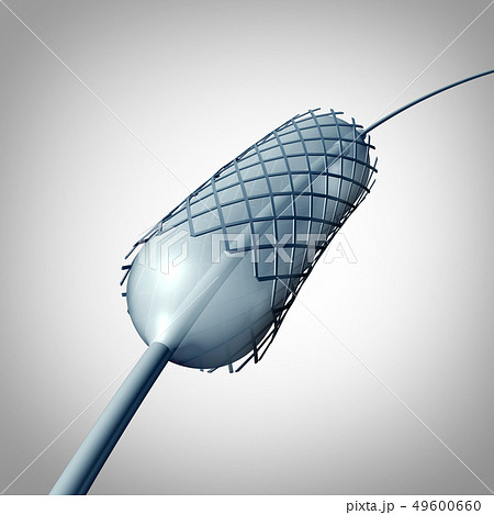 Catheter Stent Implantation Catheter Stent Implantation 49600660