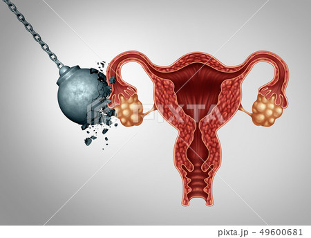 Strong Female Fertility 49600681