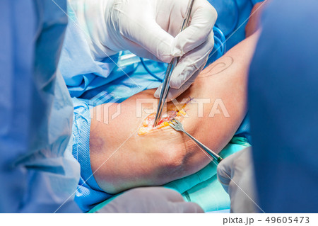 Orthopedic surgeons performing arm surgery Orthopedic surgeons performing arm surgery 49605473