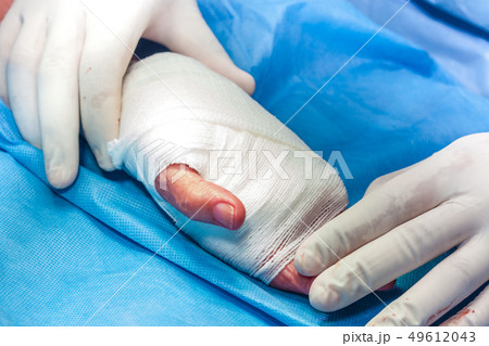 Surgeon bandaging the hand of a patient Surgeon bandaging the hand of a patient 49612043