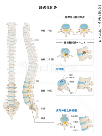 腰の仕組みと腰痛のメカニズムのイラスト素材