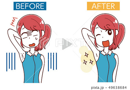 イラスト素材: エステ・女性のムダ毛処理・ビフォーアフター イラスト素材: エステ・女性のムダ毛処理・ビフォーアフター 49638684