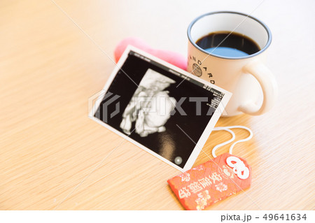 エコー写真とコーヒー エコー写真とコーヒー 49641634