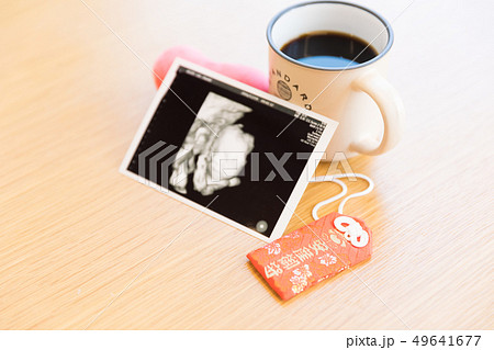 エコー写真とコーヒー 49641677