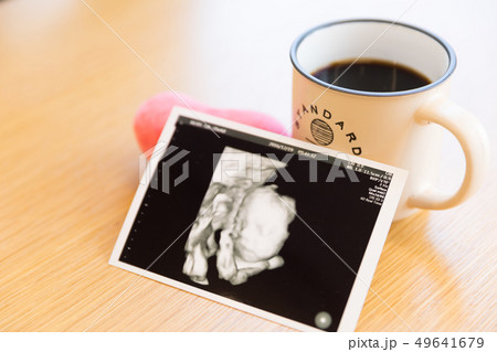 エコー写真とコーヒー 49641679