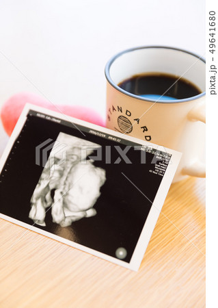 エコー写真とコーヒー エコー写真とコーヒー 49641680
