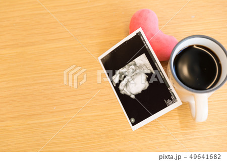 エコー写真とコーヒー 49641682