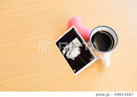 エコー写真とコーヒー エコー写真とコーヒー 49641687