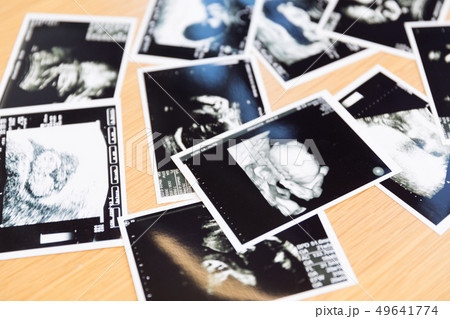 エコー写真 49641774
