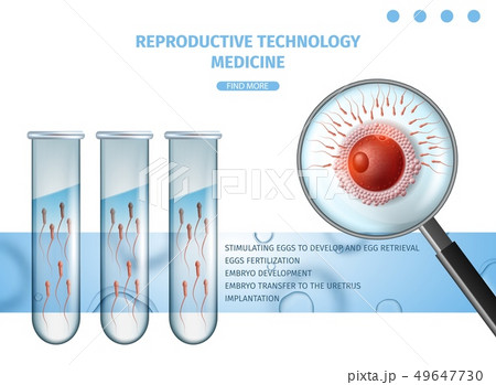 Reproductive Technology Medicine. IVF Aid Banner 49647730