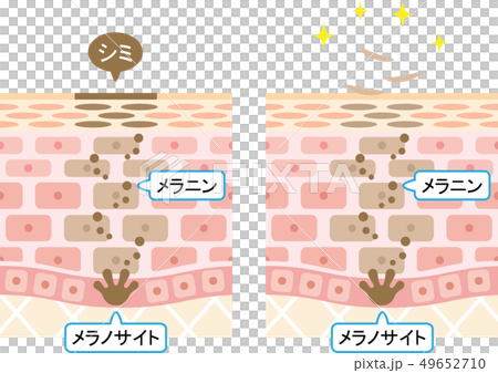 ターンオーバー　肌　断面図 49652710