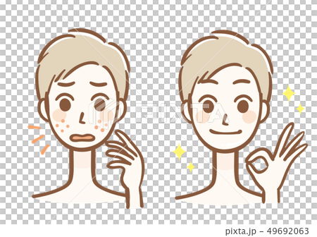 Male Acne Before After - Stock Illustration [49692063] - PIXTA