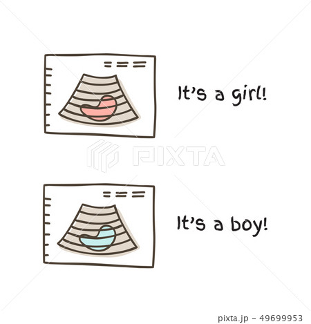 Ultrasound of baby in mothers womb doodle vector illustration Ultrasound of baby in mothers womb doodle vector illustration 49699953