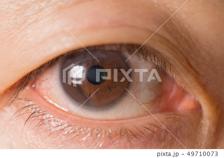 男性の目 49710073