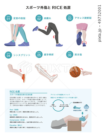 スポーツ外傷とrice処置のイラスト素材