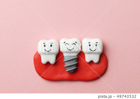 Healthy white teeth and implants are smiling on pink background. 49743532