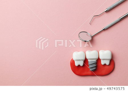 Healthy white teeth and implants  on pink background and dentist tools mirror, hook. Copy space for 49743575