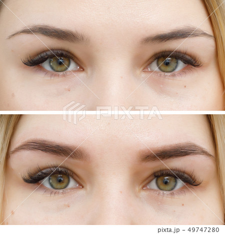 Before and after permanent makeup Before and after permanent makeup 49747280