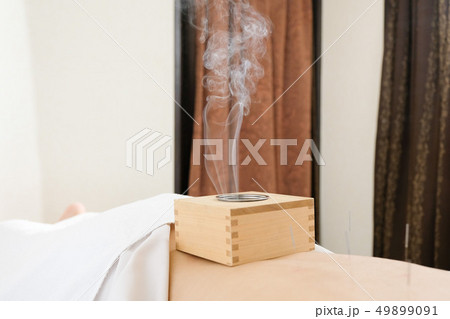 明るい鍼灸院で女性の腰に乗せられた箱灸 明るい鍼灸院で女性の腰に乗せられた箱灸 49899091