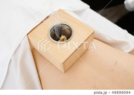 明るい鍼灸院で女性の腰に乗せられた箱灸 明るい鍼灸院で女性の腰に乗せられた箱灸 49899094
