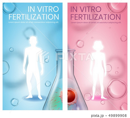 In Vitro Fertilization. Male and Female Silhouette 49899908