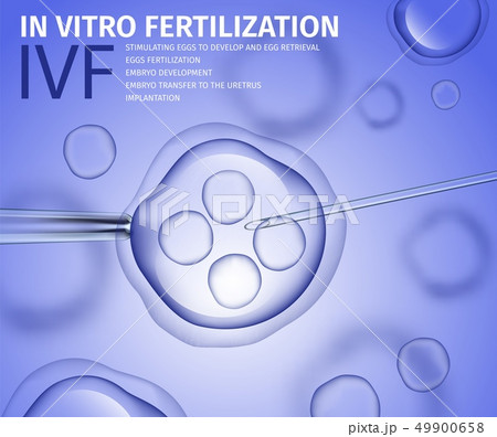 In Vitro Fertilization of Human Female Cell Macro 49900658