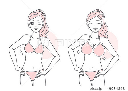 woman has breast enlargement woman has breast enlargement 49934848