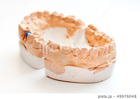 Plaster Cast of jaws. Dental casting gypsum model human Jaws in prosthetic laboratory. Dentistry Plaster Cast of jaws. Dental casting gypsum model human Jaws in prosthetic laboratory. Dentistry 49976048