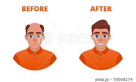 Hair growth concept 50008274