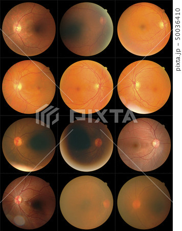 retinal images retinal images 50036410