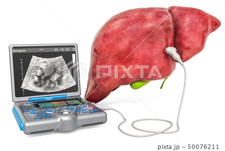 Liver Ultrasound concept 50076211