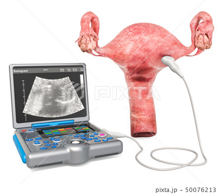 Ultrasonography of the uterus 50076213