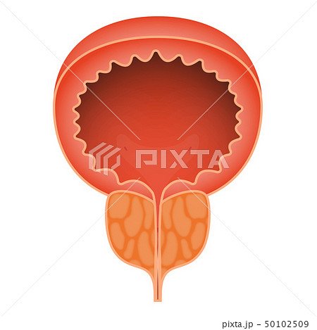 Acute prostatitis on white background. Men s reproductive system disease. Medical vector 50102509