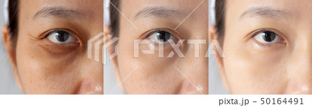 Before and After treatment for skin care problem Before and After treatment for skin care problem 50164491