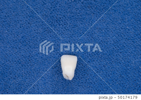 子供の抜けた歯 左前歯(左中切歯) 表側 子供の抜けた歯 左前歯(左中切歯) 表側 50174179