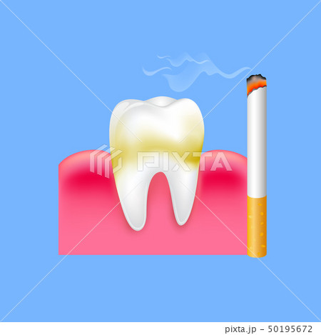 Tooth with cigarette. Tooth with cigarette. 50195672